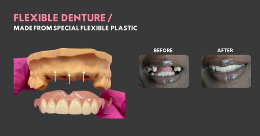 Flexible Partial Dentures - Smile Boutique NY