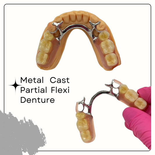 Metal Frame Denture - Smile Boutique NY