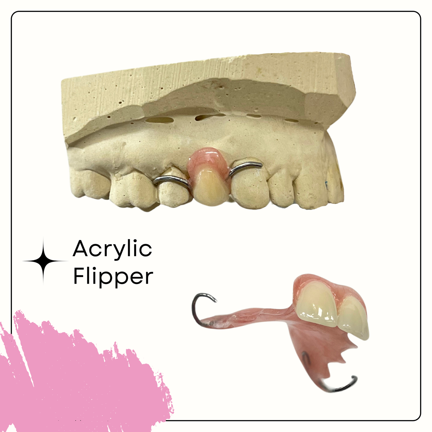 Acrylic Flipper (up to 3 teeth in a row) - Smile Boutique NY
