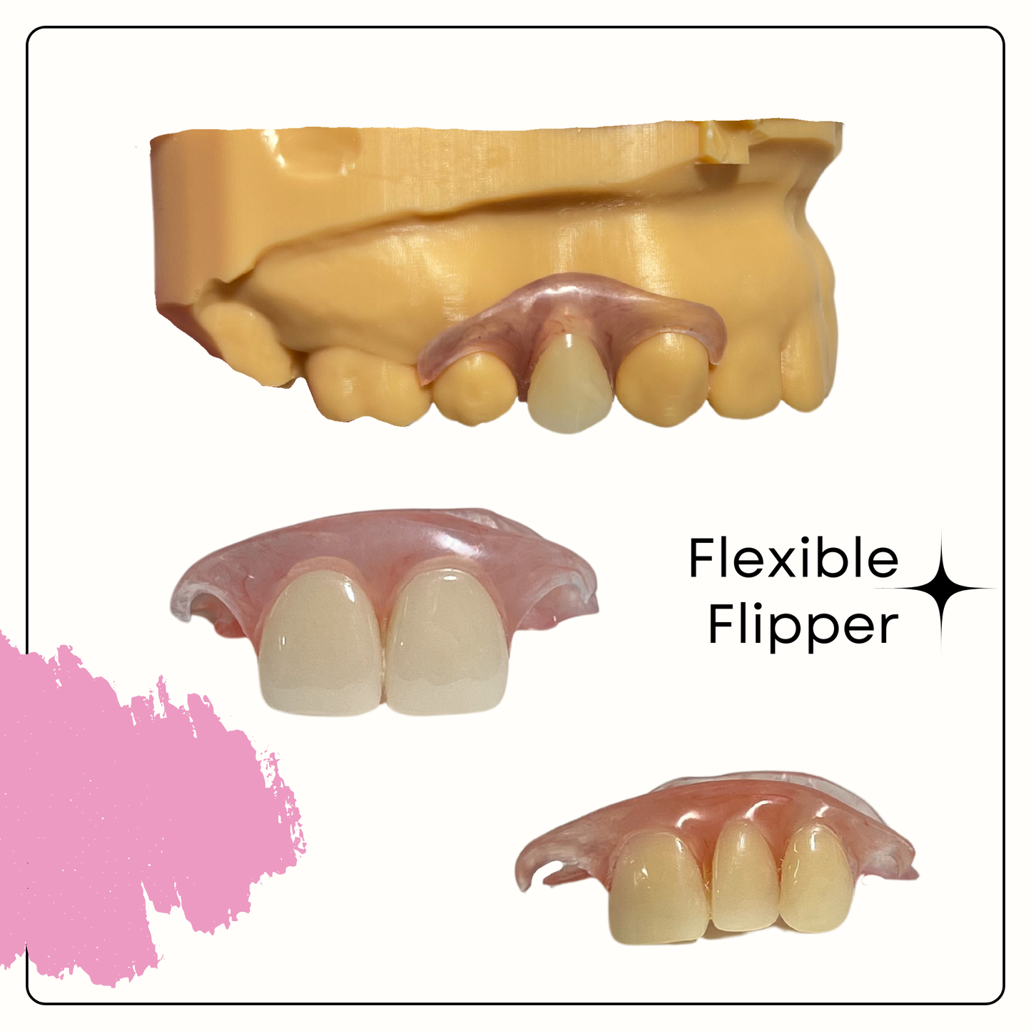 Flexible Flipper (up to 3 teeth in a row) - Smile Boutique NY