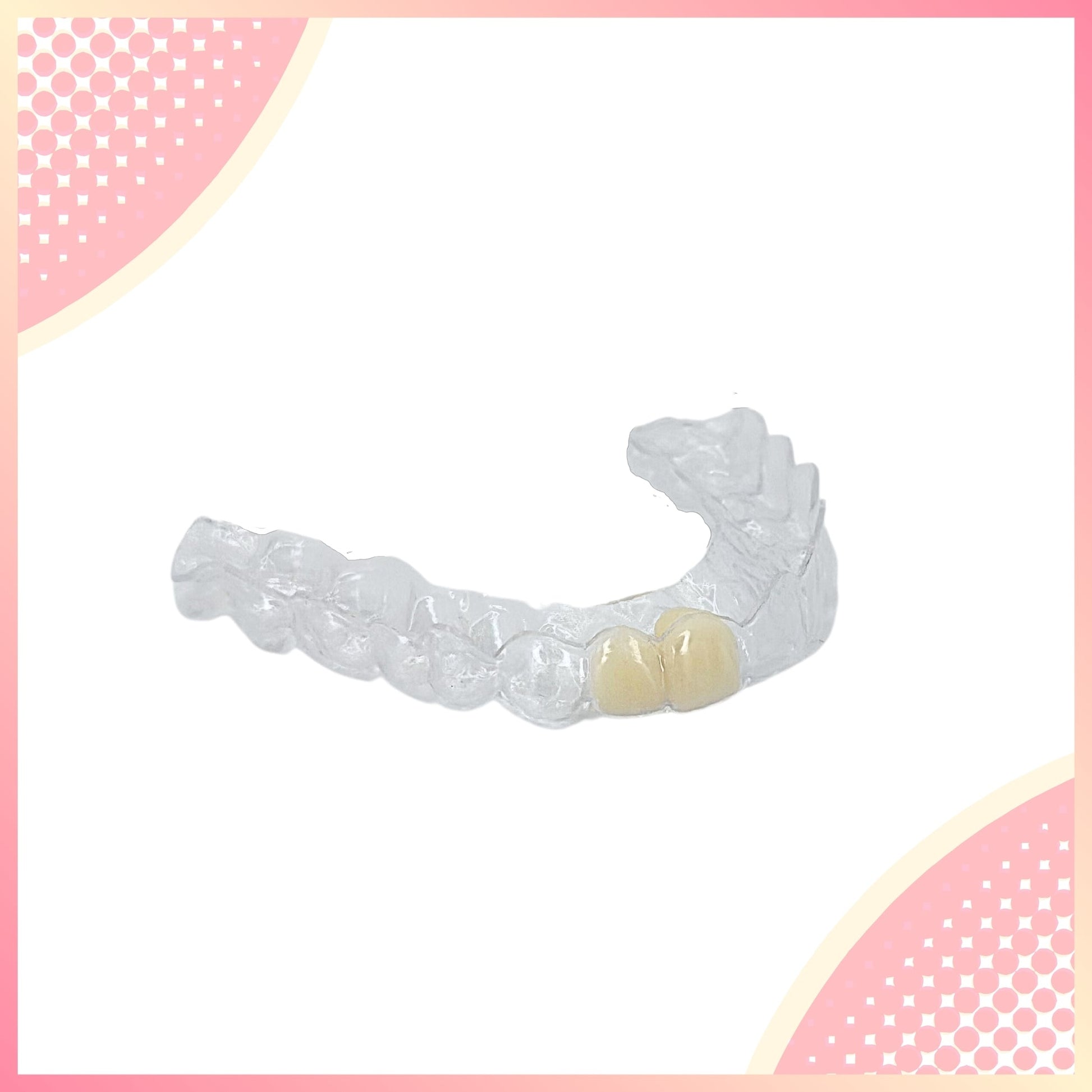 A clear Essix dental appliance, designed to fit snugly over the teeth, providing discreet alignment correction.