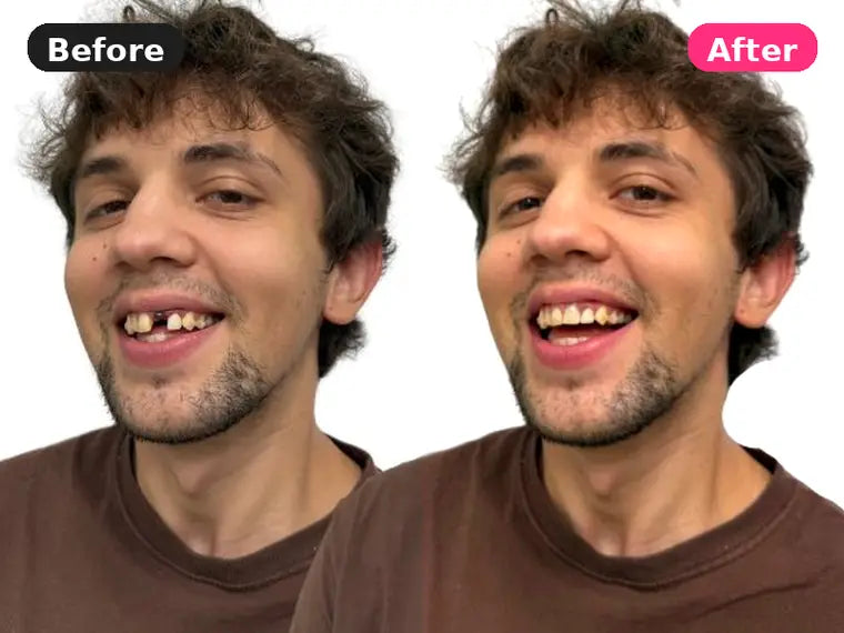 Before and after