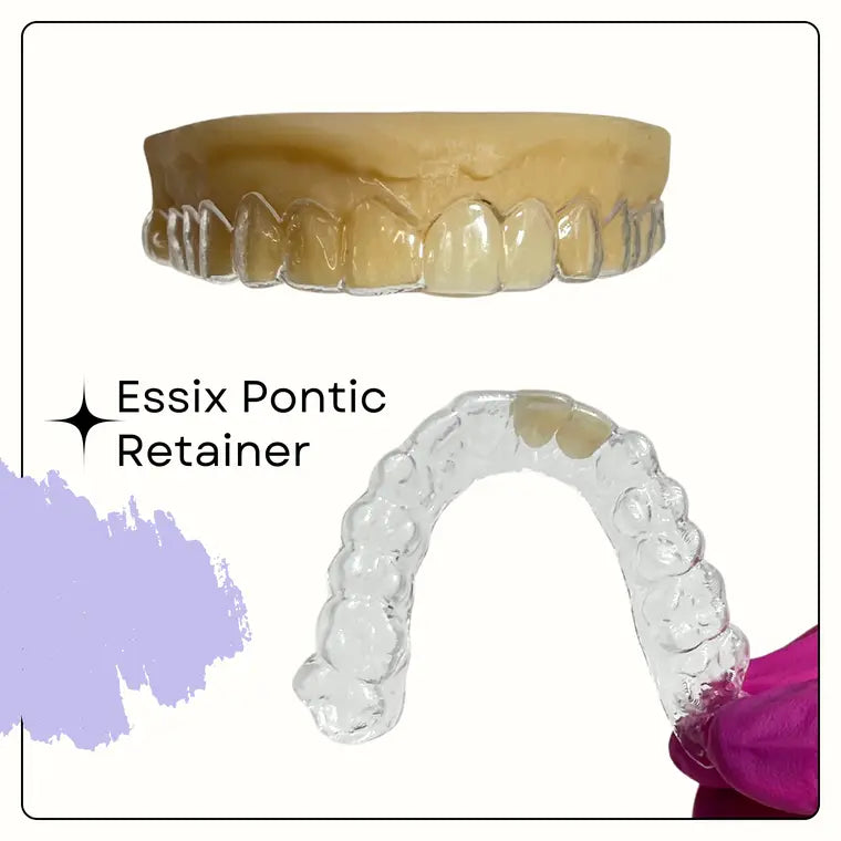 Essix Retainer with Pontic