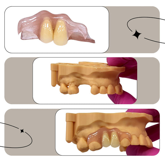 How Much Does a Flipper Tooth Cost? Explore the Differences Based on Location, Materials, and Complexity