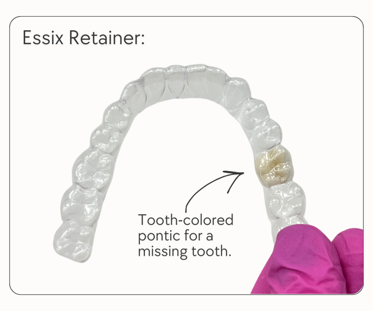 Essix Retainer