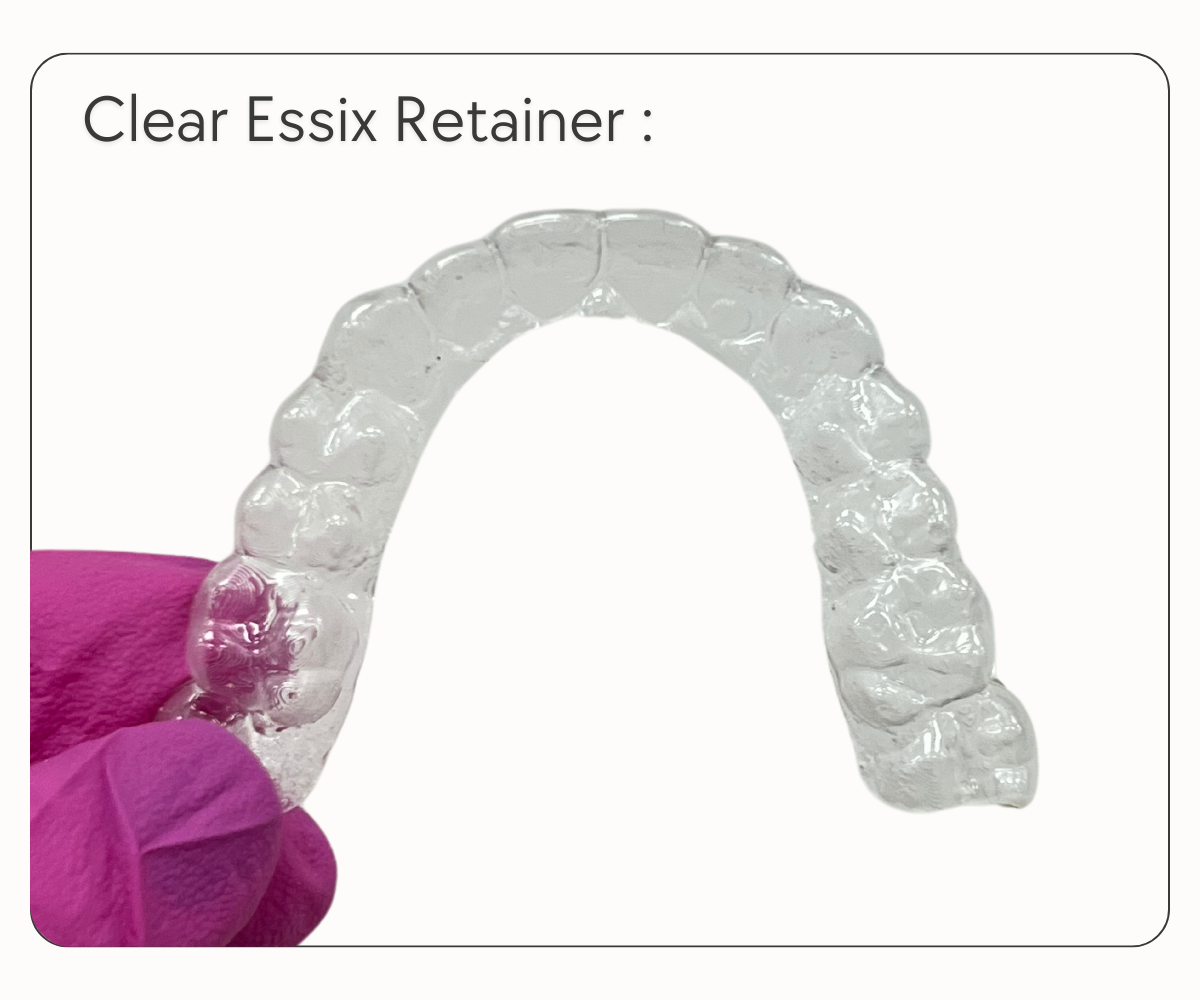 Clean Retainers The Essential Guide to Clear Retainers: Why You Need Them – Smile ...