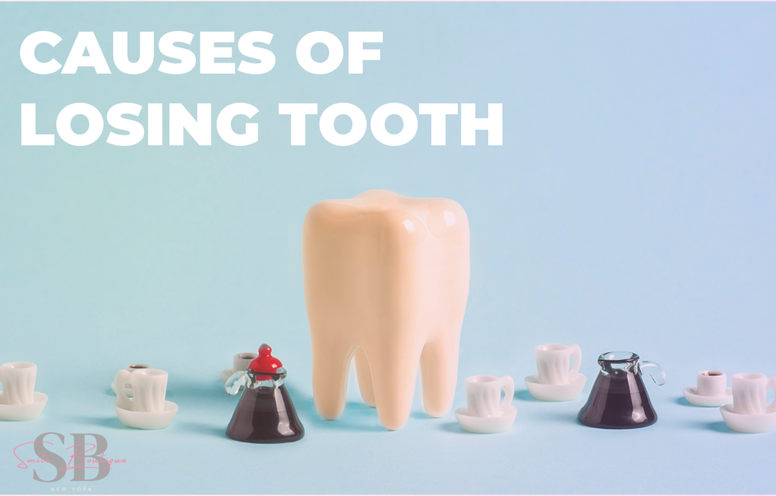 Causes of Losing Teeth