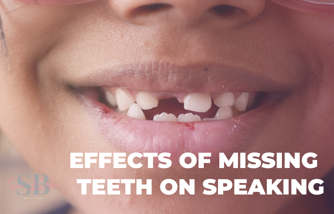 Effects of Missing Teeth On Speaking