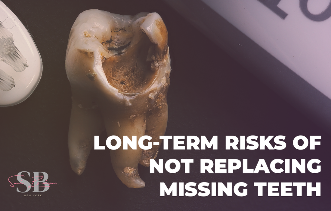 Long-Term Risks of Not Replacing Missing Teeth