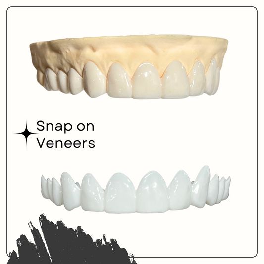 Achieve Your Dream Smile with Smile Boutique NY's Easy Smile Snap-On Veneers