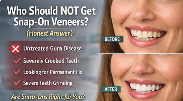 Who Should NOT Get Snap-On Veneers? (Honest Answer)