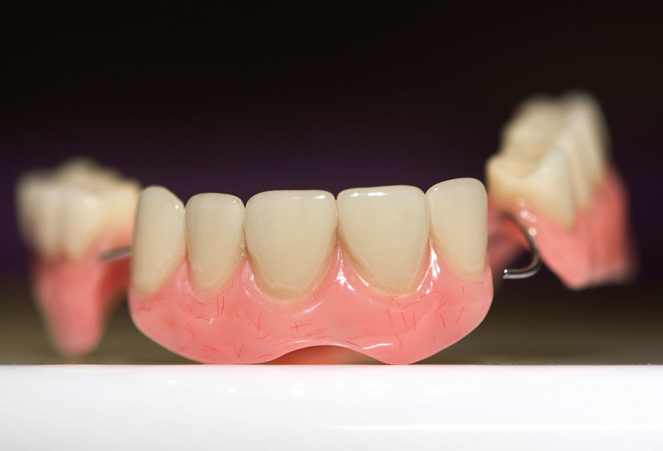 Snap-On Veneers vs. Traditional Veneers: Cost, Materials, Advantages and Disadvantages