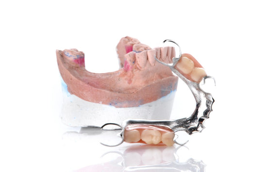How to Cover Missing Teeth While Waiting for Implants: Alternative Solutions for Your Smile