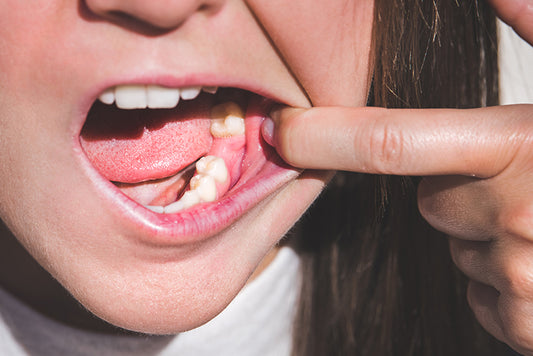 Dental Flipper for One Tooth