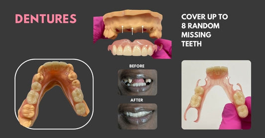 Transform Your Smile with Dentures Online: Affordable, Convenient, and High-Quality Solutions - Smile Boutique NY