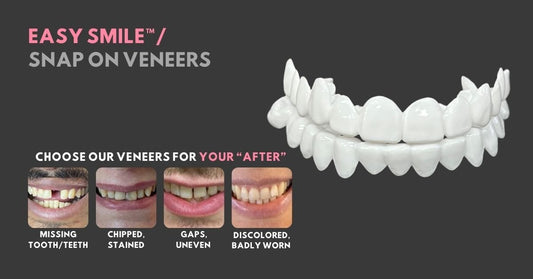 Transform Your Smile with Smile Boutique NY: The Best At-Home Veneer Kits - Smile Boutique NY