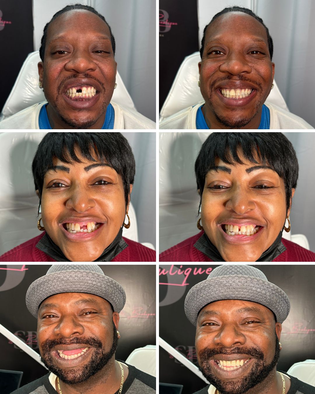 Smile Boutique NY Before and After