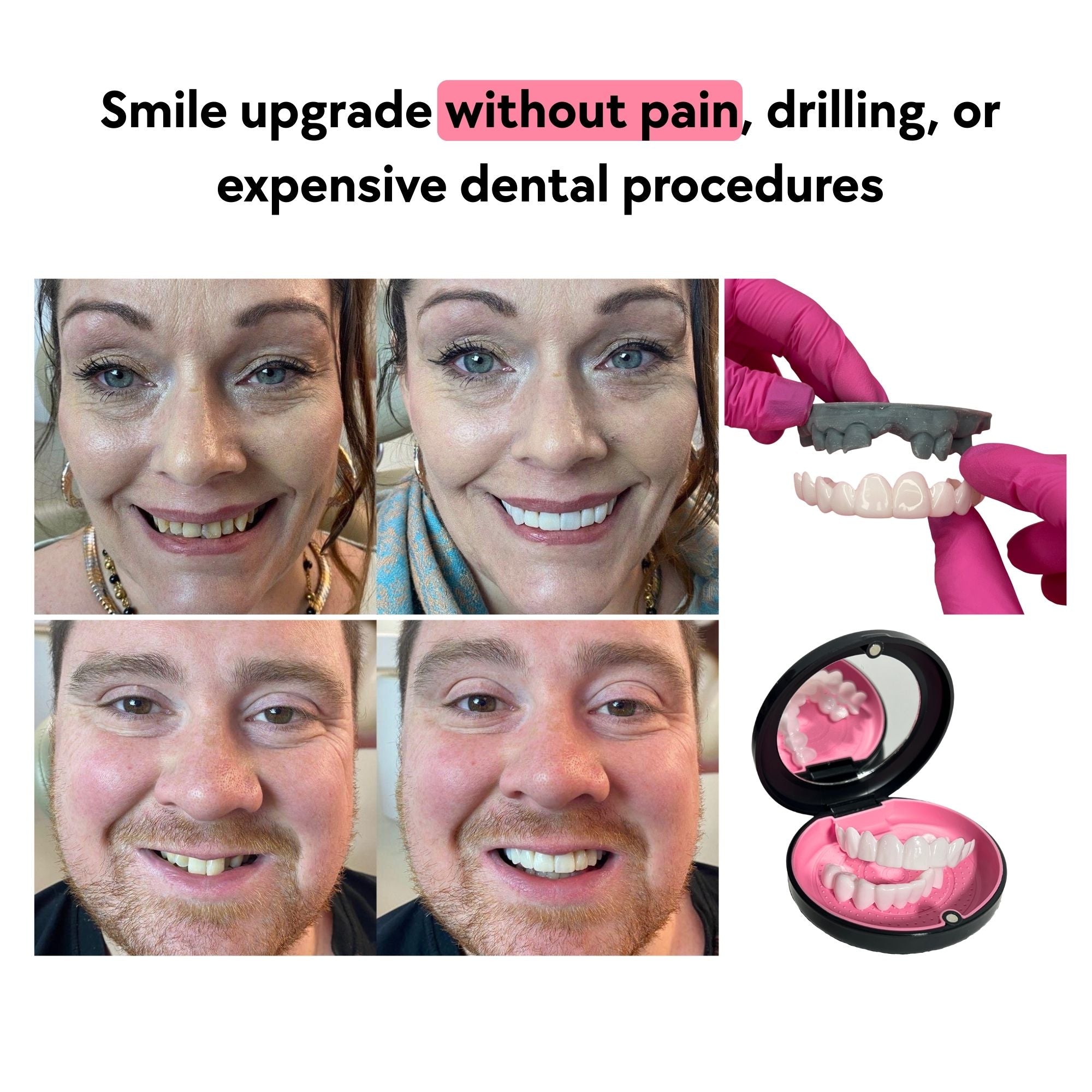 Top-Rated Snap-On Veneers Made in the USA | Affordable Removable