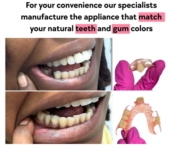 Flexible Partial Dentures Designed for Comfort and a Natural Look