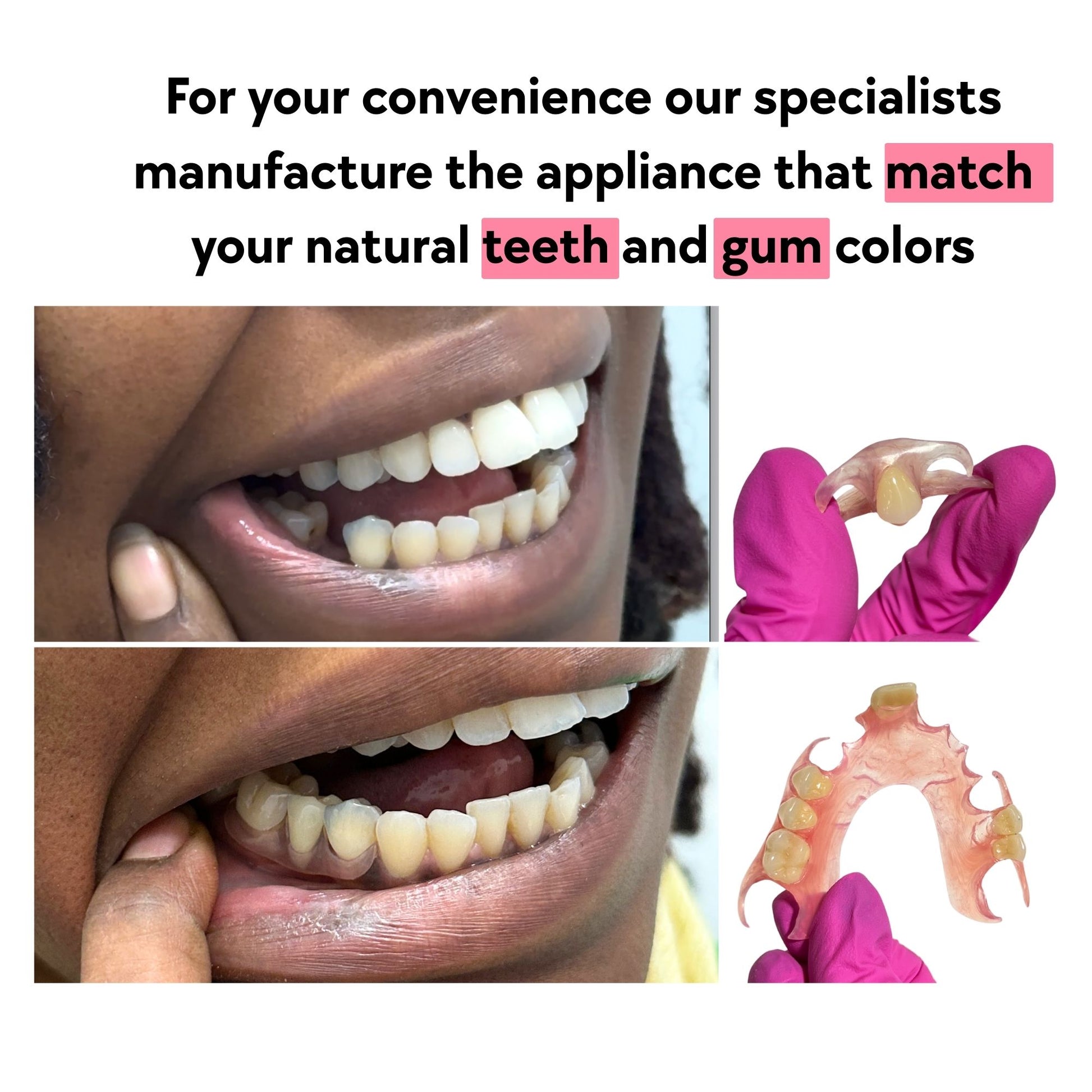 Flexible Partial Dentures Designed for Comfort and a Natural Look