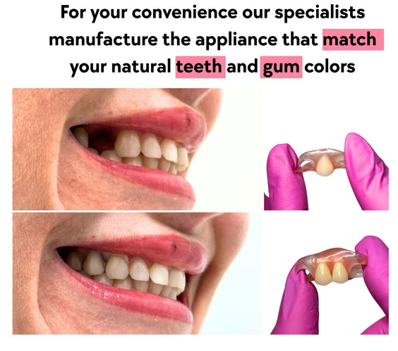 Semi flex flipper blends with your gums and matches your teeth color