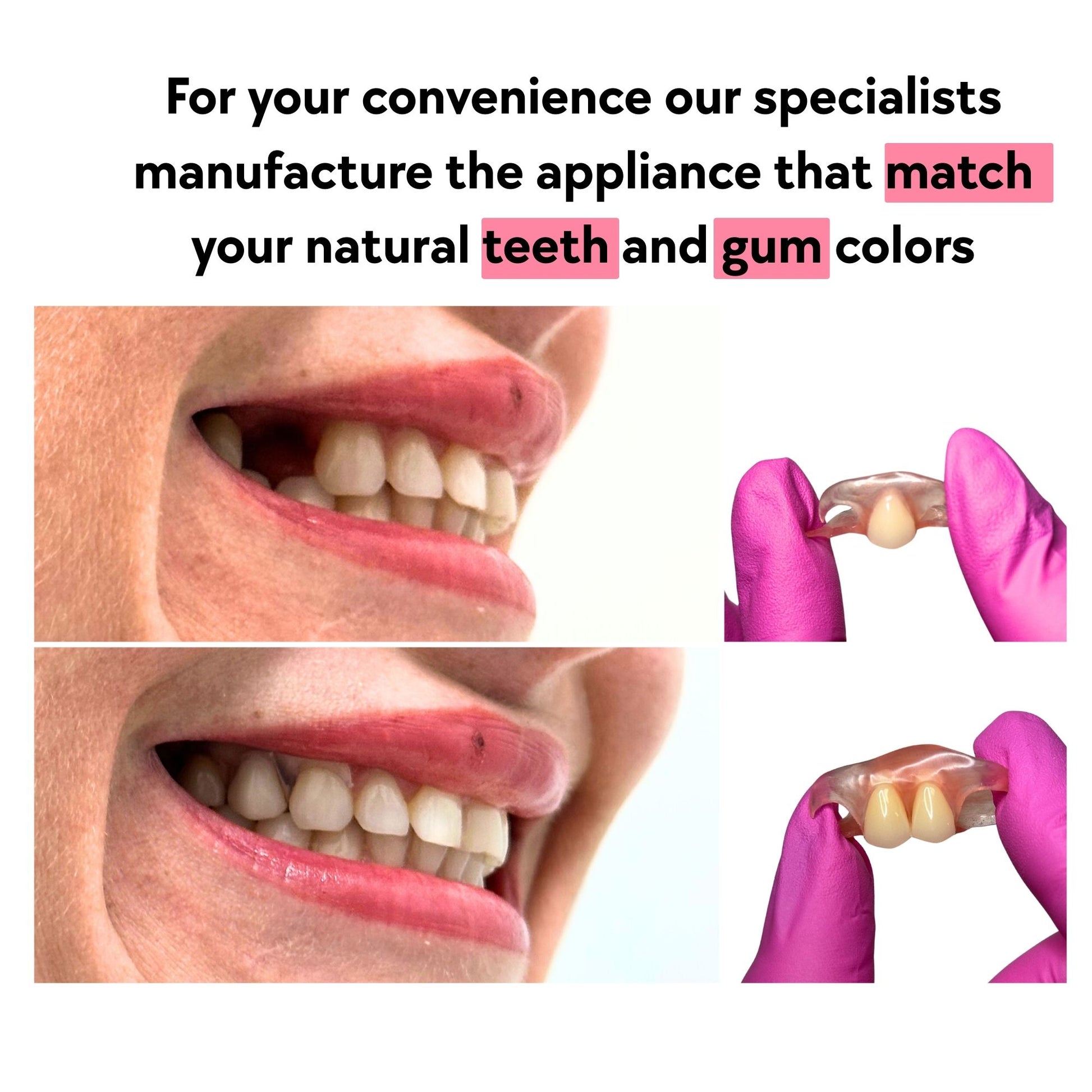 Semi flex flipper blends with your gums and matches your teeth color