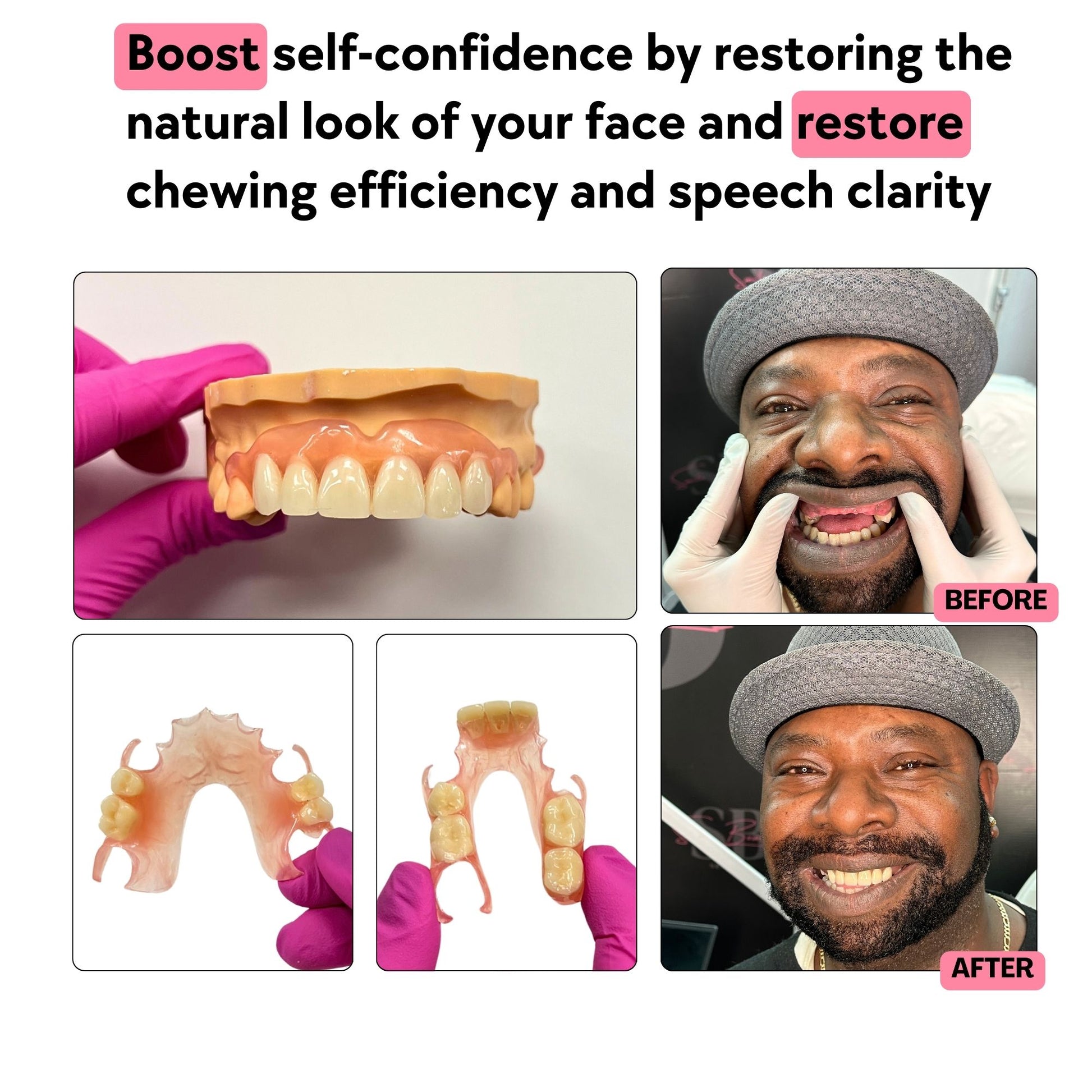 Flexible Partial Dentures Designed for Comfort and a Natural Look