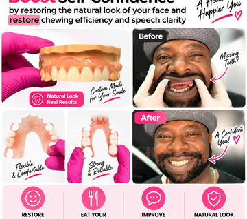 Flexible Partial Denture