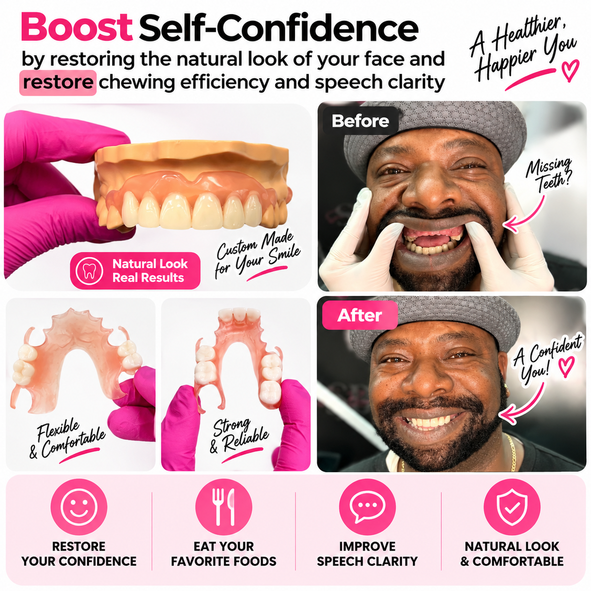 Flexible Partial Denture