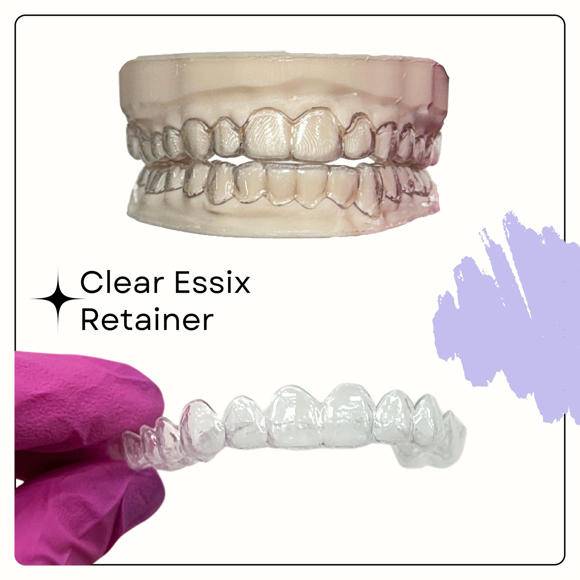 Essix Retainer - Smile Boutique NY