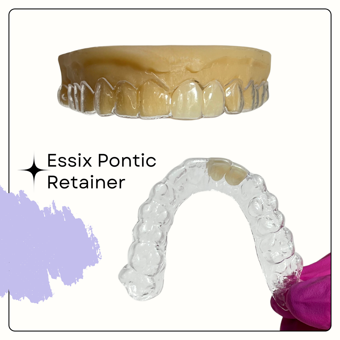 Essix Retainer - Smile Boutique NY