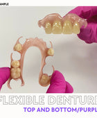 Flexible Denture