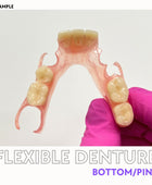 Flexible Denture