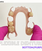 Flexible Denture