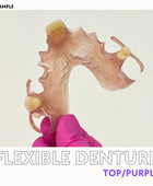 Flexible Denture