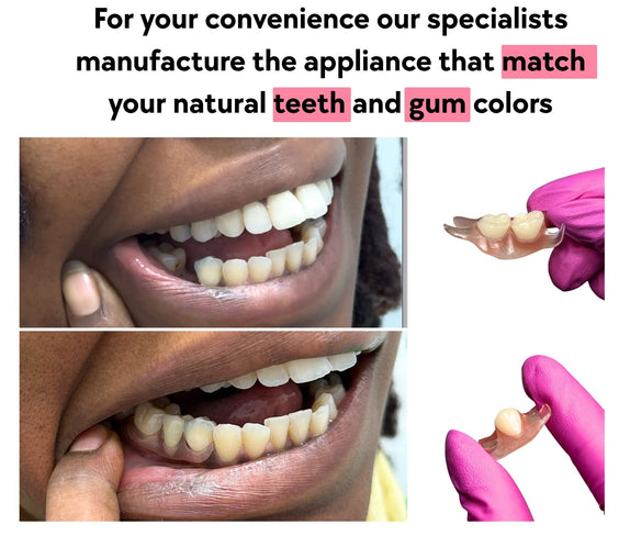flexible_flipper_1_tooth_and_2_teeth