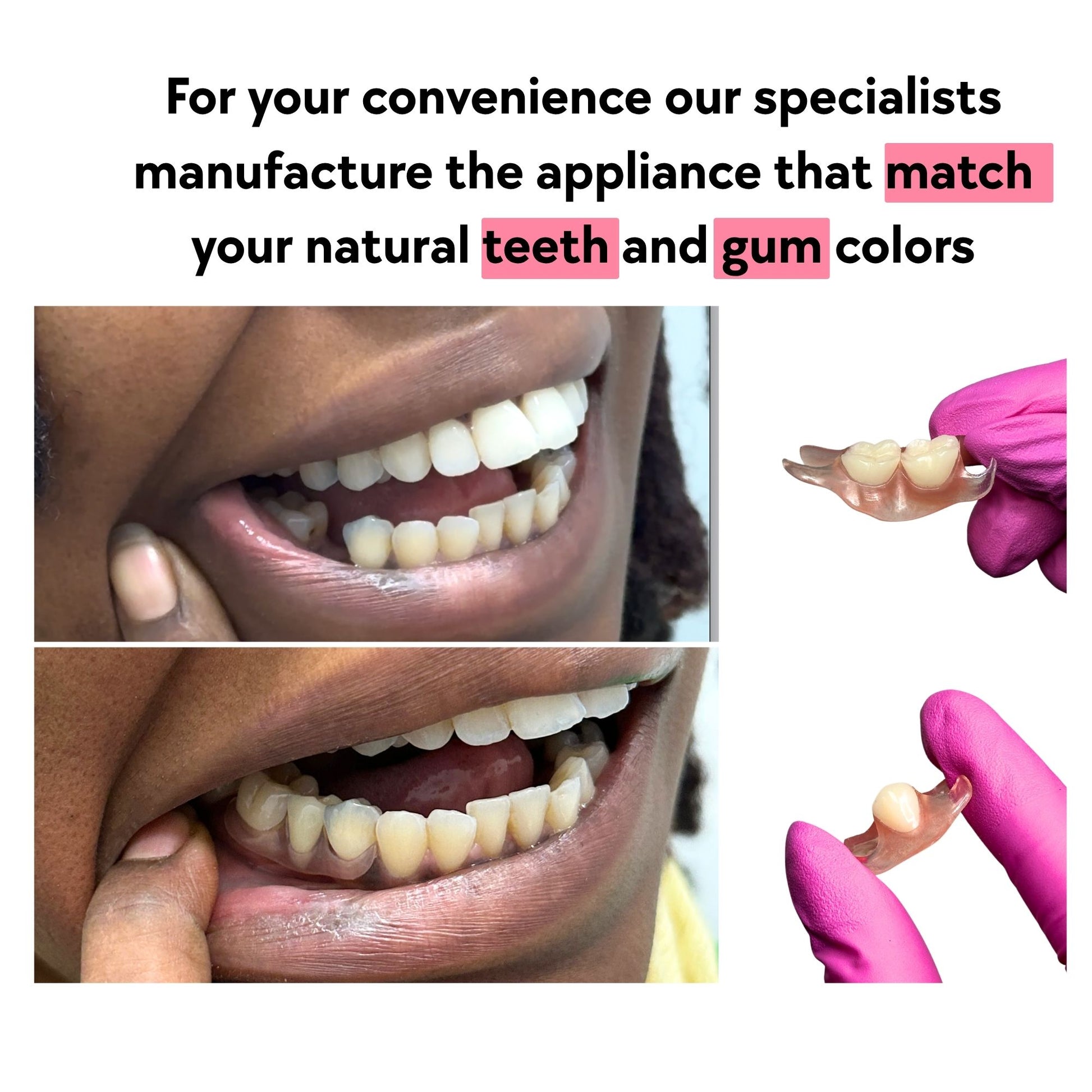 flexible_flipper_1_tooth_and_2_teeth