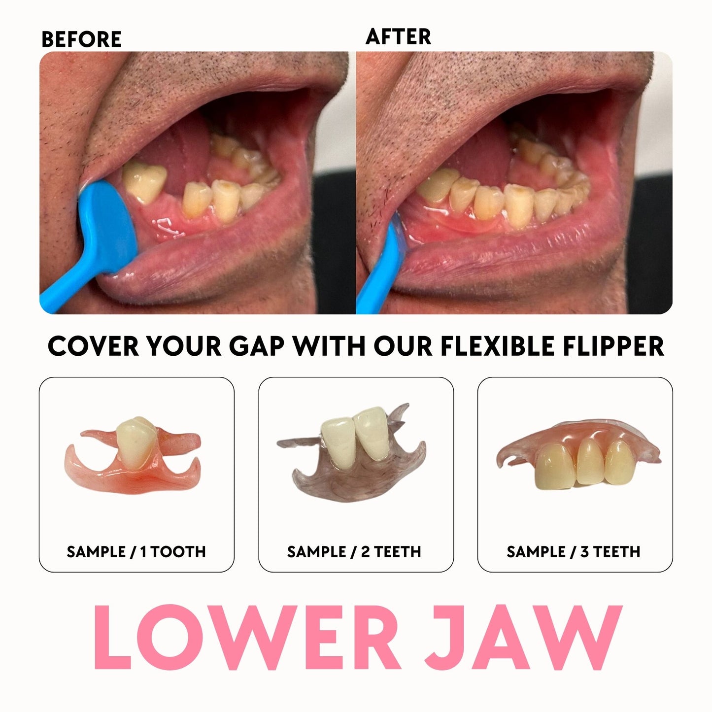 Flexi - Smile Boutique NY