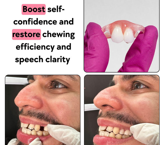 Semi Flex Flipper for up to 2 adjacent teeth