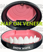 Easy Smile (Snap On Veneers)