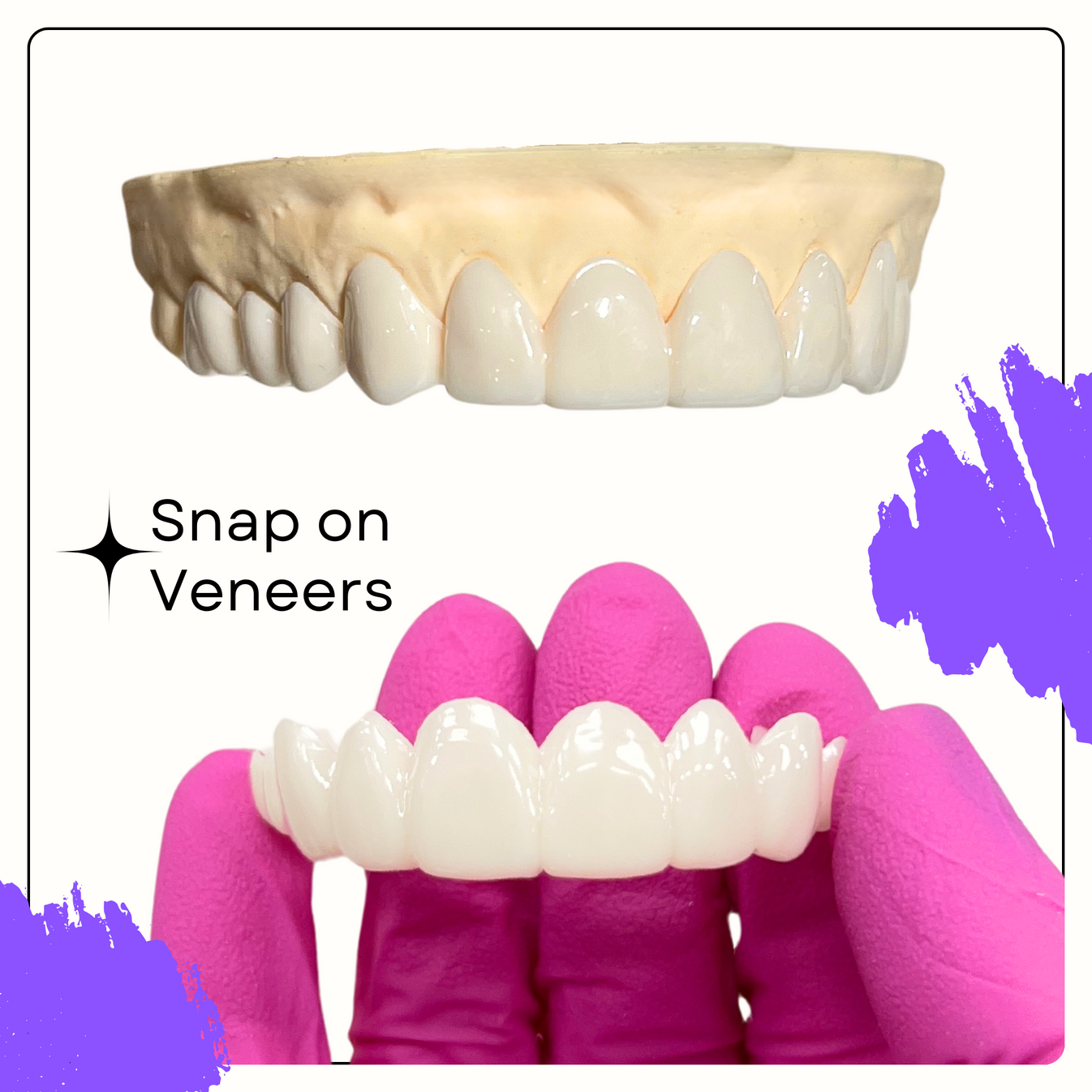 Easy Smile™ Removable Veneers for Your Perfect Smile – Smile Boutique NY