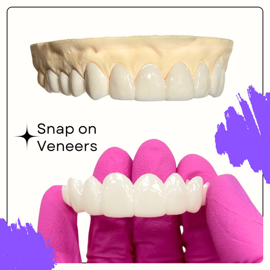 Easy Smile (Snap On Veneers) - Smile Boutique NY