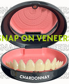 Easy Smile (Snap On Veneers)