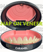 Easy Smile (Snap On Veneers)