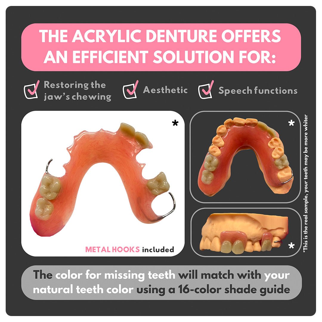 Acrylic Denture - Smile Boutique NY