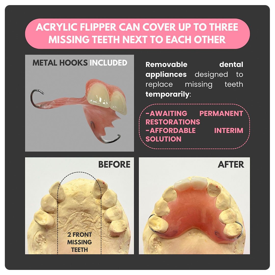 Acrylic Flipper (up to 3 teeth in a row) - Smile Boutique NY