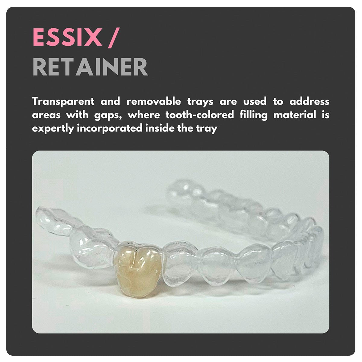 retainers with fake teeth, dental essix retainer code, false tooth retainer, cdt code for essix retainer, clear retainer with false teeth, how long do essix retainers lasts