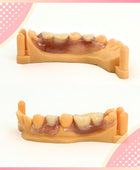 Flexible Flipper (up to 3 teeth in a row) - Smile Boutique NY