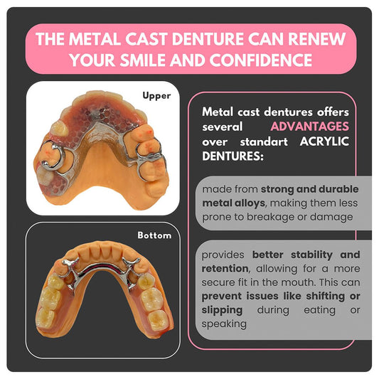 Metal Frame Denture - Smile Boutique NY