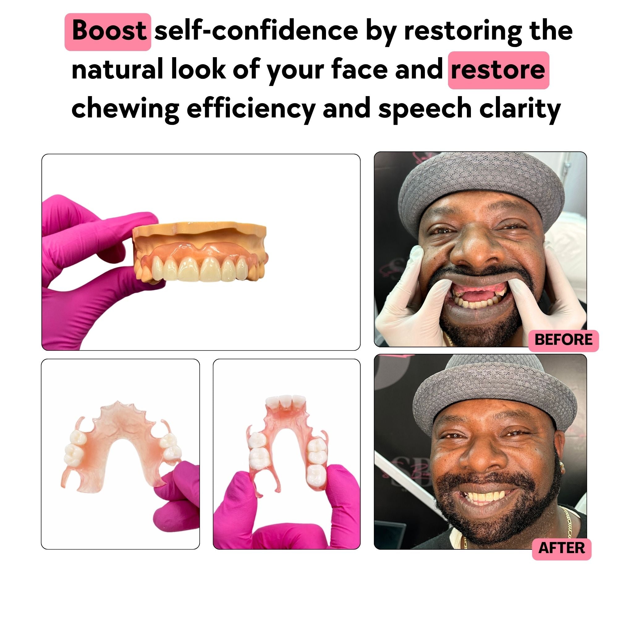 Smile Boutique NY Flexible Partial Dentures - Thumbnail 5